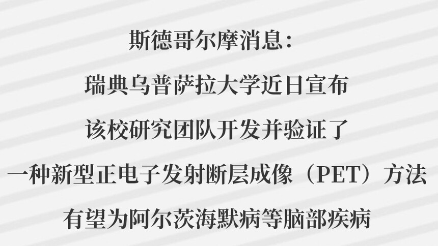 新成像法有望更安全灵活诊断阿尔茨海默病